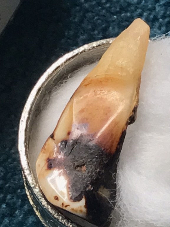 พระทันตธาตุ ครูบาอินก๋วน วัดสอบป๊าด จ.ลำปาง ได้มาจากพ่ออุดม ปัจจุบันอายุ 68 ปี ยังมีชีวิตอยู่ (บันทึก พ.ศ.2567) มีอาชีพขายอุปกรณ์ไฟฟ้าใน อ.เมือง จ,ลำปาง พ่ออุดมเคยรับใช้ครูบาอินก๋วน ระหว่างปี 2549-2557 พระทันตธาตุองค์นี้พ่ออุดมได้รับมาเมื่อ ปี 2554