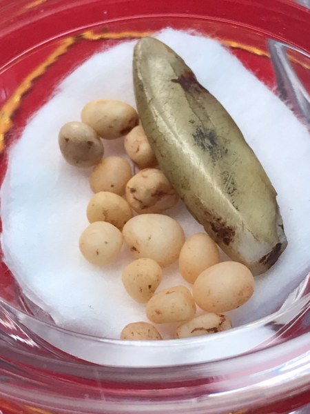 พระทันตธาตุหลวงปู่ครูบาชัยยะวงศา แกะเป็นรูปพระพุทธรูป พร้อมกับพระธาตุข้าวบิณฑ์