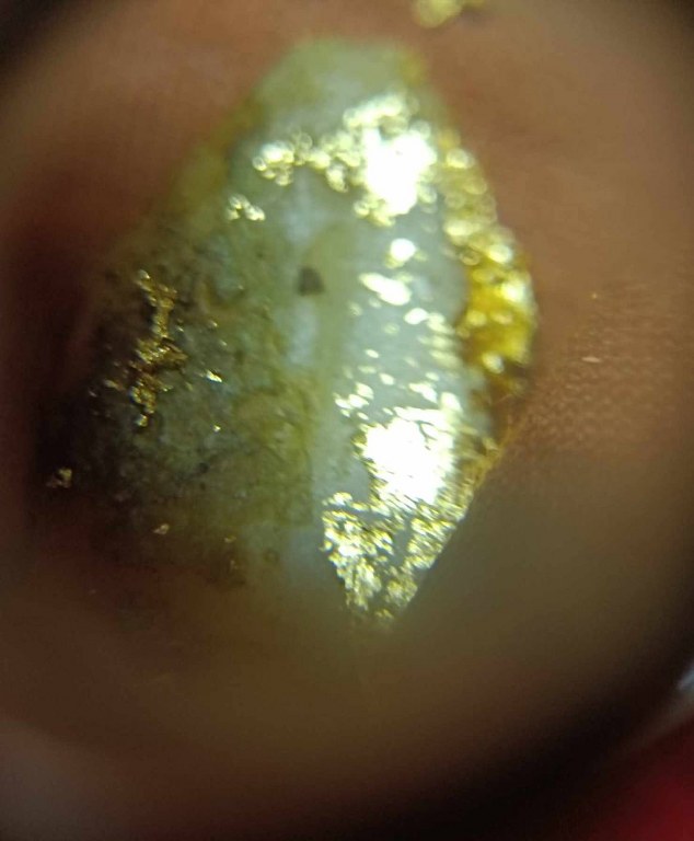 พระทันตธาตุ ครูบาธรรมธิ วัดสันป่าตึง อ.แม่แตง จ.เชียงใหม่ ได้มาจากพ่อหนานจักร อายุ 82 ปี ปัจจุบัน (พ.ศ.2567) ยังมีชีวิตอยู่ แม่แตง จ.เชียงใหม่ เคยบวชรับใช้ครูบาธรรมธิ ตั้งแต่ปี 2529 - 2536 และสึกในปี 2540 ท่านได้พระทันตธาตุนี้มาเมื่อปี 2536