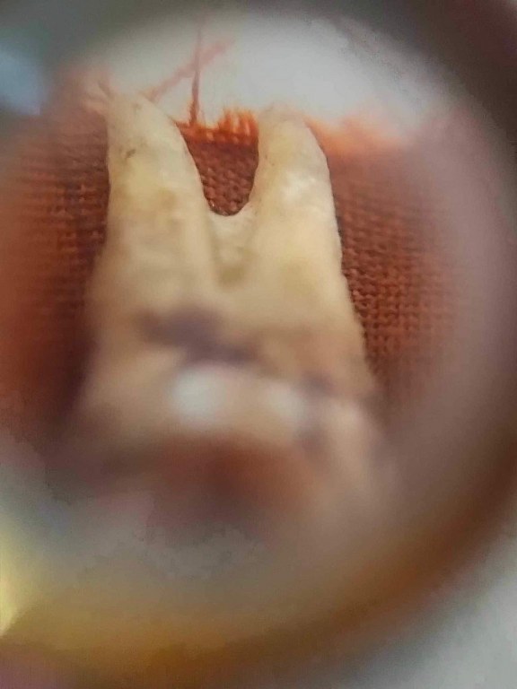 พระทันตธาตุครูบาแสง วัดร่องช้าง จ.ลำพูน ได้มาจากลุงประสิทธิ์ อดีตนายอำเภอ เวียงหนองล่อง อายุ 74 ปี เล่าว่าได้มา เมื่อสมัยที่ท่านเป็นปลัดอำเภอ อ.ป่าซาง เมื่อปี 2532 ได้จากผู้ช่วยผู้ใหญ่บ้านใน อ.ป่าซาง ซื่อว่าวิโรจน์ซึ่งมีศักดิ์เป็นหลานครูบาแสง