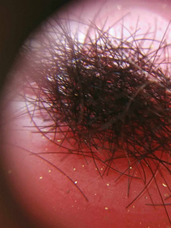 พระทันตธาตุ พระเกศา จีวร หลวงพ่อตี๋ วัดพรหมวิหาร อ.แม่สาย จ.เชียงราย เจ้าของเดิมชื่อลุงสงวน เคยเป็นคนขับรถหลวงพ่อตี๋ อยู่บ้านป่าเหมือด ต.แม่สาย อ.แม่สาย จ.เชียงราย เสียชีวิตเมื่อวันที่ 9 มีนาคม 2558 อายุ 78 ปี ได้มาจากพี่พร อายุ 47 ปี ลูกสาวลุงสงวน