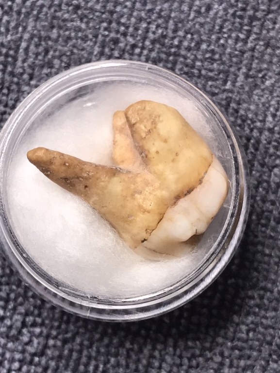 พระทันคธาตุุครูบาจักร วัดทุ่งโป่ง อ.บ้านโฮ่ง จ.ลำพูน ได้มาจากพ่อหลวงนิด หรือผู้ใหญ่บ้านบ้านเหล่ายาว อ.บ้านโฮ่ง จ.ลำพูน ปัจจุบันอายุ 58 ปี (บันทึก พ.ศ.2567) ท่านได้รับสืบต่อมาจากพ่อของท่่านชื่อพ่ออุ้นหนานปัน หากมีชีวิตอยู่จนปัจจุบันจะมีอายุ 95 ปี