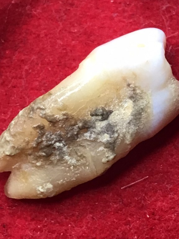 พระทันตธาตุ ครูบาติ๊บ วัดท่าวังพร้าว อ.สันป่าตอง จ.เชียงใหม่ ได้มาจากกำนันคำ อดีตกำนันบ้านปากกอง อ.สารภี จ.เชียงใหม่ ปัจจุบันอายุ 86 ปี (บันทึก พ.ศ.2566) กำนันคำได้พระทันตธาตุครูบาติ๊บ ได้มาเมื่อปี พ.ศ.2549 ได้มาจากลูกศิษย์ครูบาติ๊บ ชื่อลุงวิโรจน์