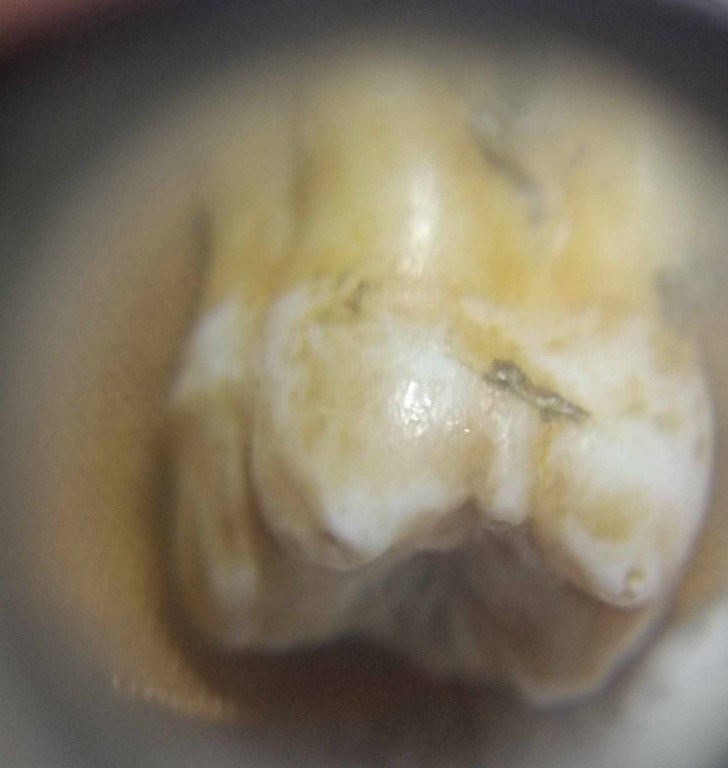 พระทันตธาตุครูบาศรีวัย วัดหนองเงือก อ.ป่าซาง จ.ลำพูน ครูบาศรีวัย ท่านมรณะภาพเมื่อปี 2556 ได้มาจากสล่าบอย อายุ 50 ปี เป็นหลานพ่อหนานแดง พ่อหนานแดงเคยรับใช้ครุบาศรีวัย พ่อหนานแดงเสียชีวิตแล้วเมื่อปี 2549 หากยังมีชีวิตอยู่ถึงปัจจุบัก็จะมีอายุ 95 ปี