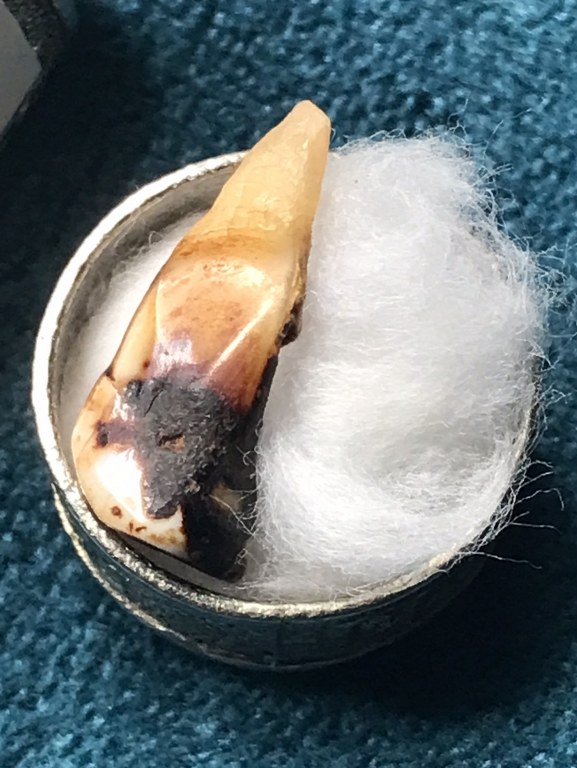 พระทันตธาตุ ครูบาอินก๋วน วัดสอบป๊าด จ.ลำปาง ได้มาจากพ่ออุดม ปัจจุบันอายุ 68 ปี ยังมีชีวิตอยู่ (บันทึก พ.ศ.2567) มีอาชีพขายอุปกรณ์ไฟฟ้าใน อ.เมือง จ,ลำปาง พ่ออุดมเคยรับใช้ครูบาอินก๋วน ระหว่างปี 2549-2557 พระทันตธาตุองค์นี้พ่ออุดมได้รับมาเมื่อ ปี 2554