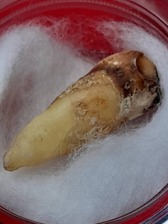 พระทันตธาตุครูบาคำแสง วัดพระธาตุสันขวาง อ.เมือง จ.เชียงราย ได้มาจากลุงหนานธงชัย อายุ 78 ปี พ่อหนานธงชัยเป็นกรรมการวัดเหมืองแดง อ.แม่สาย จ.เชียงราย และทำงานเป็นหมอยารักษาคนแบบวิชาโบราณล้านนา