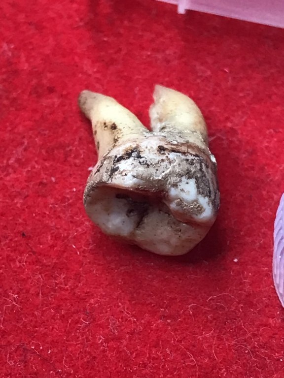 พระทันตธาตุครูบาคำแสน วัดป่าดอนมูล จ.เชียงใหม่ ได้มาจากกำนันคำ อดีตกำนันบ้านปากกอง อ.สารภี จ.เชียงใหม่ ปัจจุบันอายุ 86 ปี กำนันคำจะมีคนคอยหาวัตถุมงคลให้ ชื่อว่าลุงสมควร ปัจจุบันเสียชีวิตแล้ว ถ้ามีชีวิตอยู่ถึงปัจจุบันน่าจะมีอายุประมาณ 70 ปี