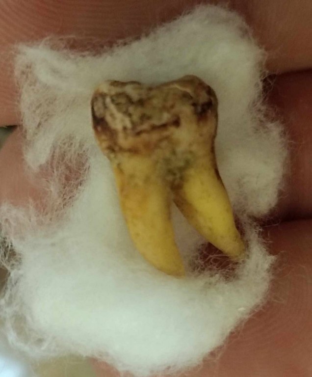 พระทันตธาตุครูบาคำแสน วัดป่าดอนมูล จ.เชียงใหม่ ได้มาจากกำนันคำ อดีตกำนันบ้านปากกอง อ.สารภี จ.เชียงใหม่ ปัจจุบันอายุ 86 ปี กำนันคำจะมีคนคอยหาวัตถุมงคลให้ ชื่อว่าลุงสมควร ปัจจุบันเสียชีวิตแล้ว ถ้ามีชีวิตอยู่ถึงปัจจุบันน่าจะมีอายุประมาณ 70 ปี