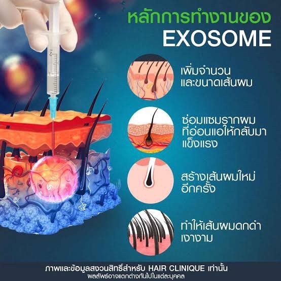 Asce Exosome 1 ขวด เอ็กโซโซม ช่วยดูแลผมร่วงผมบาง Exosome Therapy for Hair Loss