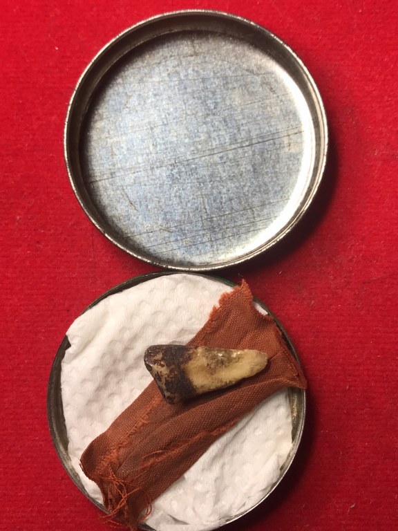 พระทันตธาตุครูบาสองเมือง วัดหล่ายแก้ว อ.บ้านโฮ่ง จ.ลำพูน พระอนันต์ เป็นศิษย์ครูบาสองเมือง ท่านสิ้นชีวิตแล้วเมื่อปี 2539 หากมีชีวิตอยู่ปัจจุบันจะมีอายุ 88 ปี (บันทึก พ.ศ.2566) ได้มอบให้ สจ.บอย อายุ 48 ปี อยู่หมู่บ้านเรือน อ.ป่าซาง จ.ลำพูน