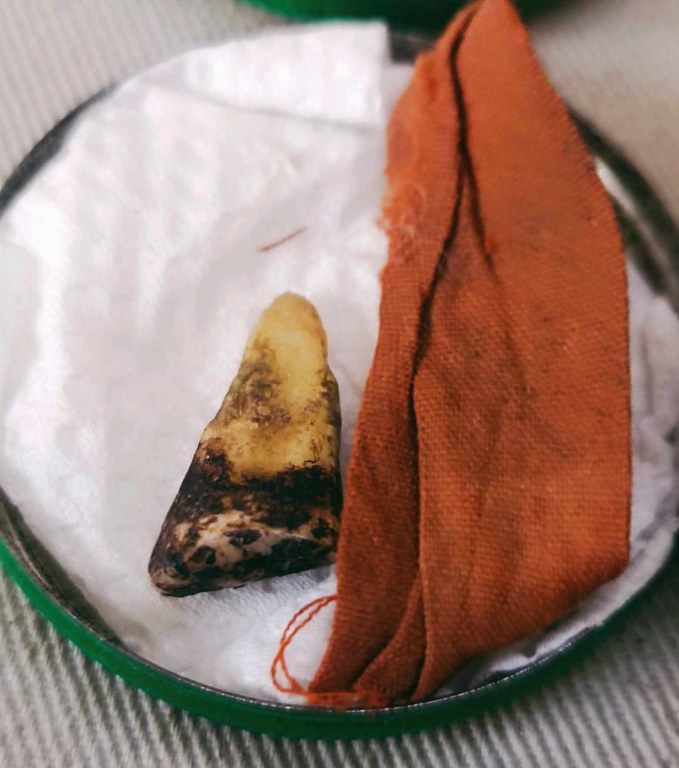 พระทันตธาตุครูบาสองเมือง วัดหล่ายแก้ว อ.บ้านโฮ่ง จ.ลำพูน พระอนันต์ เป็นศิษย์ครูบาสองเมือง ท่านสิ้นชีวิตแล้วเมื่อปี 2539 หากมีชีวิตอยู่ปัจจุบันจะมีอายุ 88 ปี (บันทึก พ.ศ.2566) ได้มอบให้ สจ.บอย อายุ 48 ปี อยู่หมู่บ้านเรือน อ.ป่าซาง จ.ลำพูน