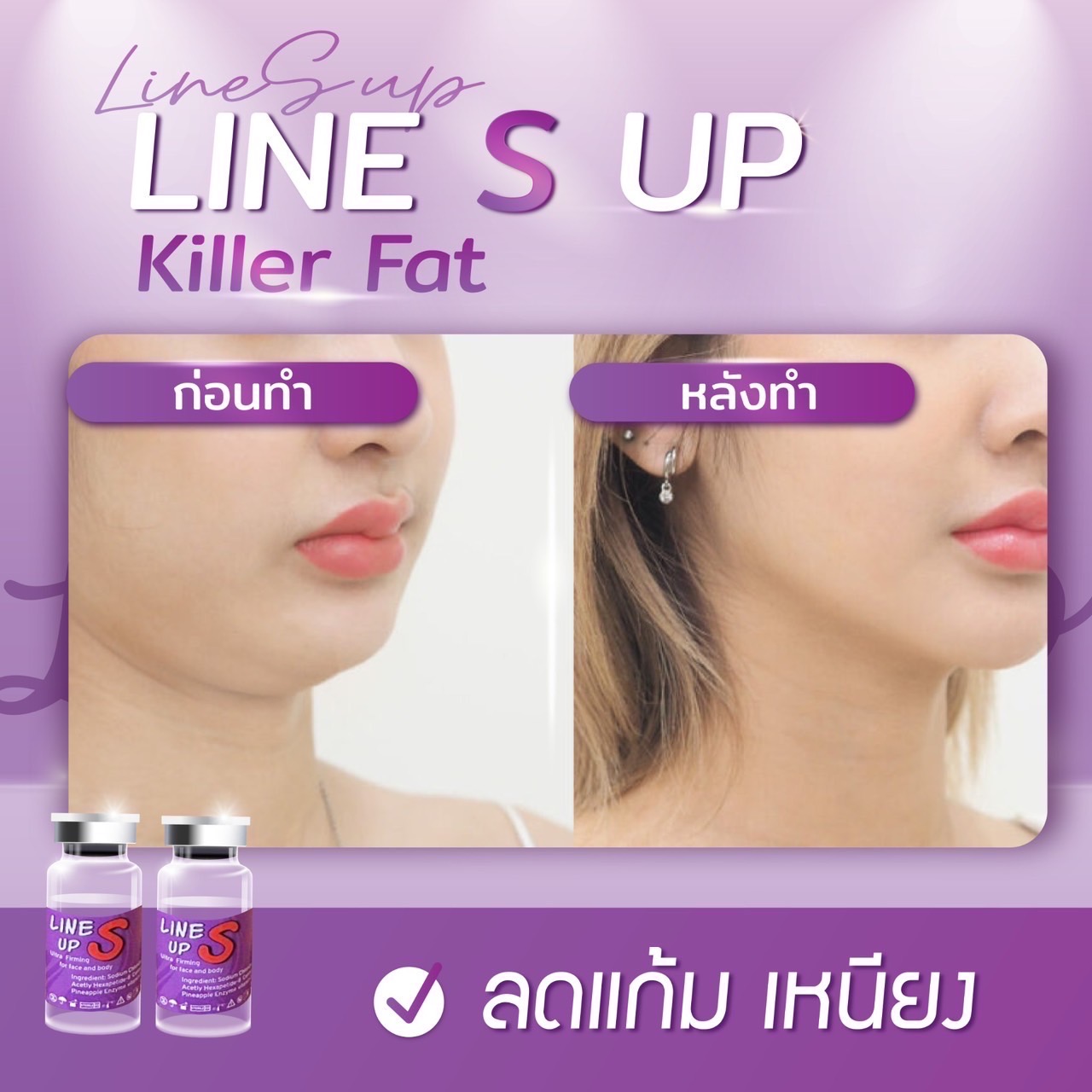 Line S Up / (1 ขวด)