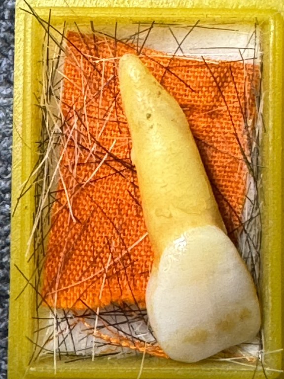 พระทันตธาตุ ครูบาฝ้าย วัดพระธาตุดอยตุง อ.แม่สาย จ.เชียงราย ได้มาจากดาบจรูญ อาศัยอยู่ที่ อ.แม่สาย จ.เชียงราย อายุ 68 ปี ปัจจุบันยังมีชีวิตอยู่ ดาบจรูญเป็นศิษย์ครูบาฝ้ายตั้งแต่ปี 2545 ดาบจรูญท่านได้พระทันตธาตุนี้มาเมื่อปี 2554