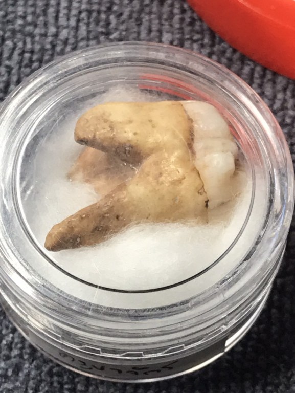 พระทันคธาตุุครูบาจักร วัดทุ่งโป่ง อ.บ้านโฮ่ง จ.ลำพูน ได้มาจากพ่อหลวงนิด หรือผู้ใหญ่บ้านบ้านเหล่ายาว อ.บ้านโฮ่ง จ.ลำพูน ปัจจุบันอายุ 58 ปี (บันทึก พ.ศ.2567) ท่านได้รับสืบต่อมาจากพ่อของท่่านชื่อพ่ออุ้นหนานปัน หากมีชีวิตอยู่จนปัจจุบันจะมีอายุ 95 ปี