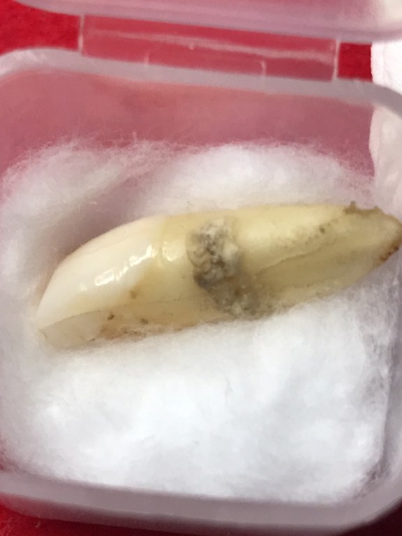 พระทันตธาตุครูบาอินทร์คำ วัดไชยสถาน อ.สารภี จ.เชียงใหม่ ได้มาจากพ่อหลวงชา ปัจจุบันอายุ 68 ปี (บันทึก พ.ศ.2566) อดีตผู้ใหญ่บ้าน ใน อ.แม่แตง จ.เชียงใหม่ พ่อหลวงชาเล่าว่าได้มาจากพ่อหนานทา อายุ 74 ปี เมื่อปี 2553