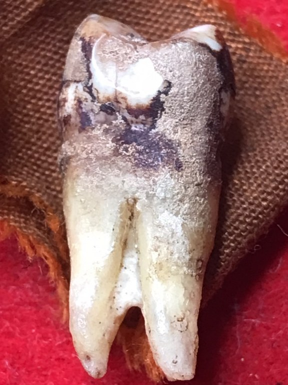 พระทันตธาตุครูบาแสง วัดร่องช้าง จ.ลำพูน ได้มาจากลุงประสิทธิ์ อดีตนายอำเภอ เวียงหนองล่อง อายุ 74 ปี เล่าว่าได้มา เมื่อสมัยที่ท่านเป็นปลัดอำเภอ อ.ป่าซาง เมื่อปี 2532 ได้จากผู้ช่วยผู้ใหญ่บ้านใน อ.ป่าซาง ซื่อว่าวิโรจน์ซึ่งมีศักดิ์เป็นหลานครูบาแสง