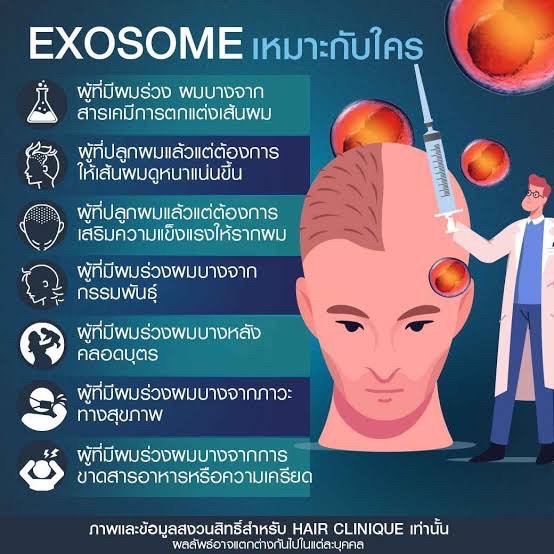 Asce Exosome 1 ขวด เอ็กโซโซม ช่วยดูแลผมร่วงผมบาง Exosome Therapy for Hair Loss