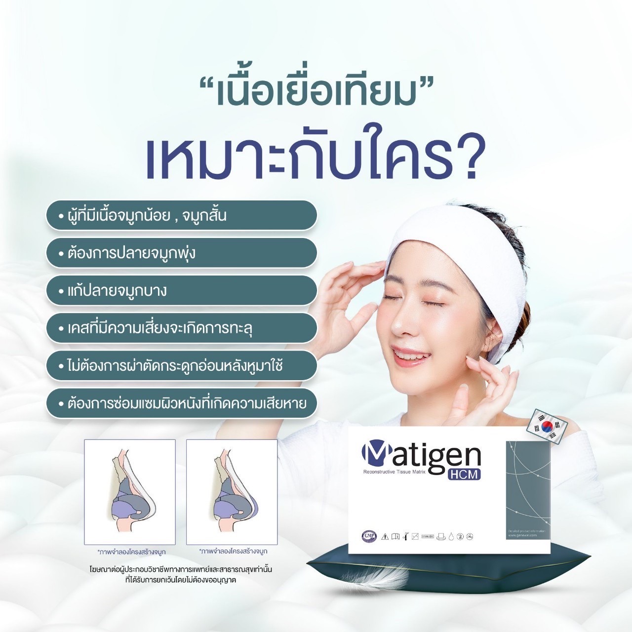 Matigen HCM / (1 กล่อง)