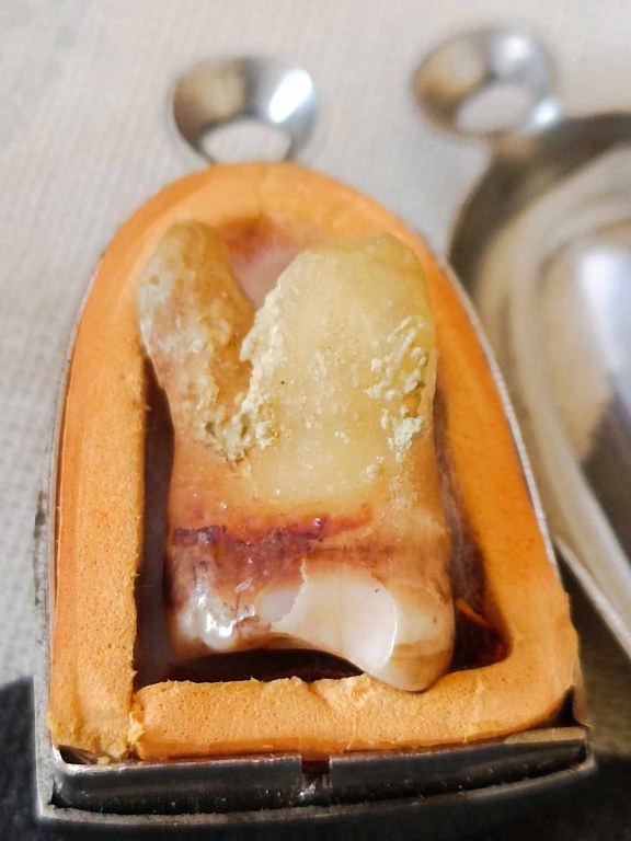 พระทันตธาตุหลวงปู่หล้า นี้ได้จากกำนันคำ อดีตกำนันบ้านปากกอง อ.สารภี จ.เชียงใหม่ ปัจจุบันอายุ 86 ปี (บันทึก พ.ศ.2566) กำนันคำเล่าว่าท่านเคยรับใช้หลวงปู่หล้าในช่วงปี 2530 ส่วนพระทันตธาตุองค์นี้ท่านได้รับมาจากมือหลวงปู่หล้า เมื่อปี 2533