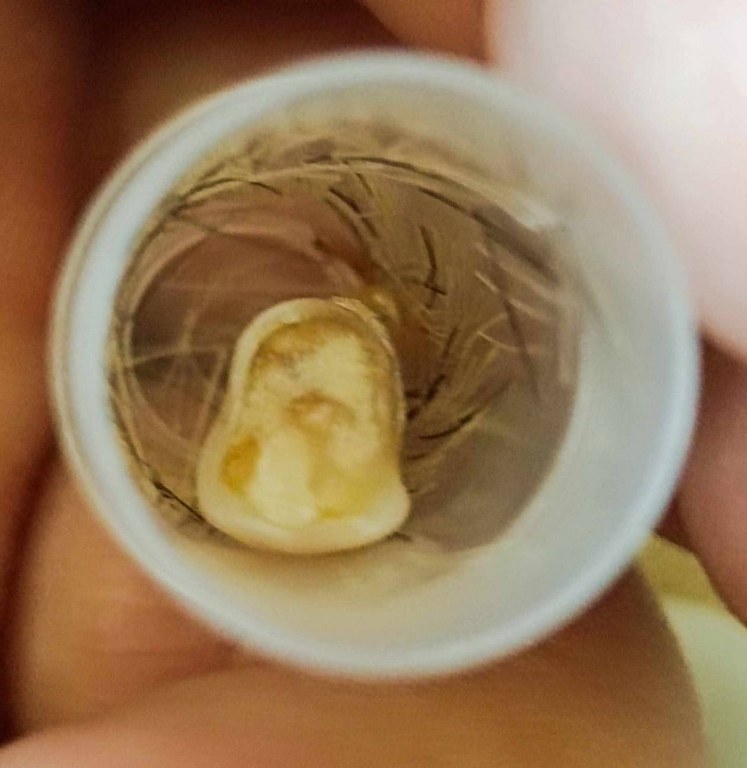 พระทันตธาตุครูบากองแก้ว วัดต้นยางหลวง จ.เชียงใหม่ ได้มาจากกำนันคำ อดีตกำนันบ้านปากกอง อ.สารภี จ.เชียงใหม่ ปัจจุบันอายุ 86 ปี (บันทึก พ.ศ.2566) กำนันคำจะมีคนคอยหาวัตถุมงคลให้ ชื่อว่าลุงสมควรปัจจุบันเสียชีวิตแล้ว ถ้ามีชีวิตอยู่น่าจะมีอายุประมาณ 70 ปี