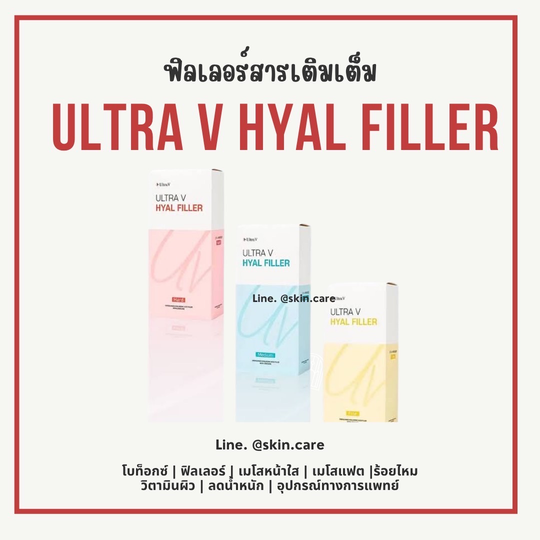Ultra v hyal filler