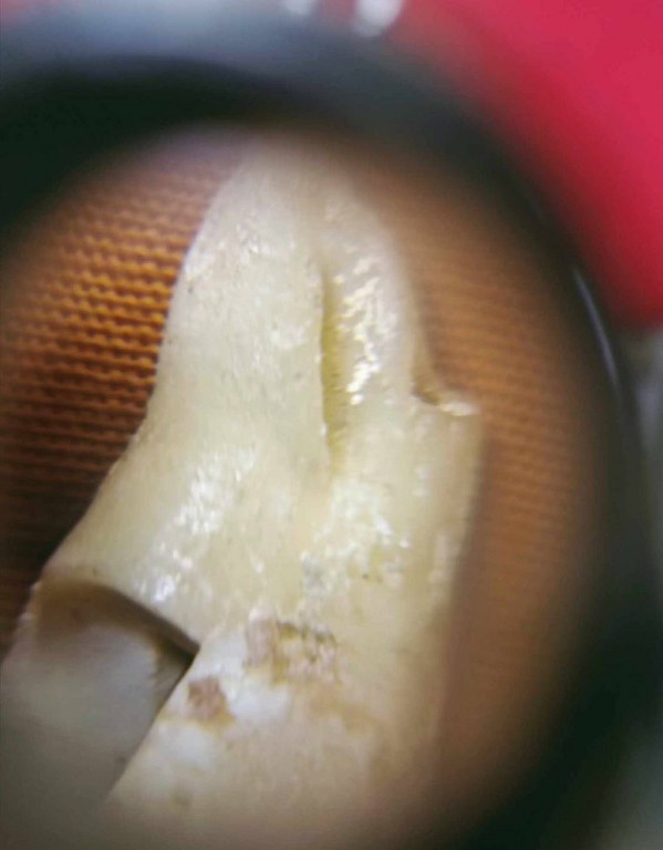 พระทันตธาตุ พระเกศา จีวร หลวงพ่อตี๋ วัดพรหมวิหาร อ.แม่สาย จ.เชียงราย เจ้าของเดิมชื่อลุงสงวน เคยเป็นคนขับรถหลวงพ่อตี๋ อยู่บ้านป่าเหมือด ต.แม่สาย อ.แม่สาย จ.เชียงราย เสียชีวิตเมื่อวันที่ 9 มีนาคม 2558 อายุ 78 ปี ได้มาจากพี่พร อายุ 47 ปี ลูกสาวลุงสงวน