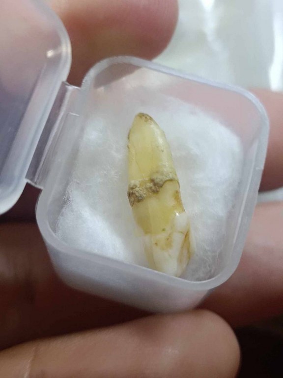 พระทันตธาตุครูบาอินทร์คำ วัดไชยสถาน อ.สารภี จ.เชียงใหม่ ได้มาจากพ่อหลวงชา ปัจจุบันอายุ 68 ปี (บันทึก พ.ศ.2566) อดีตผู้ใหญ่บ้าน ใน อ.แม่แตง จ.เชียงใหม่ พ่อหลวงชาเล่าว่าได้มาจากพ่อหนานทา อายุ 74 ปี เมื่อปี 2553