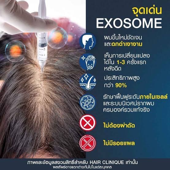 Asce Exosome 1 ขวด เอ็กโซโซม ช่วยดูแลผมร่วงผมบาง Exosome Therapy for Hair Loss