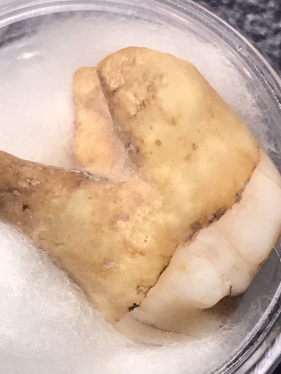 พระทันคธาตุุครูบาจักร วัดทุ่งโป่ง อ.บ้านโฮ่ง จ.ลำพูน ได้มาจากพ่อหลวงนิด หรือผู้ใหญ่บ้านบ้านเหล่ายาว อ.บ้านโฮ่ง จ.ลำพูน ปัจจุบันอายุ 58 ปี (บันทึก พ.ศ.2567) ท่านได้รับสืบต่อมาจากพ่อของท่่านชื่อพ่ออุ้นหนานปัน หากมีชีวิตอยู่จนปัจจุบันจะมีอายุ 95 ปี