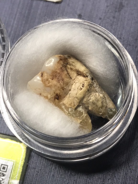 พระทันตธาตุครูบาสิงห์ทอง อินทวังโส วัดป่าบุก ต.แม่แรง อ.ป่าซาง จ,ลำพูน ได้จากหนานชัย ปัจจุบันอายุ 65 ปี (บันทึกปี 2567) ขอยของชำในตลาดสด อ.ป่าซาง เคยบวชอยู่ที่วัดป่าบุก เคยเป็นศิษย์รับใช้ครูบาสิงห์ทอง