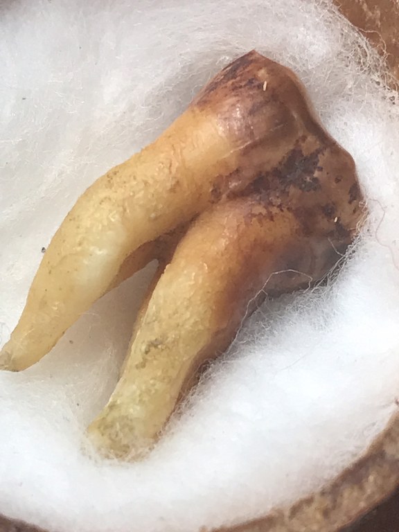 พระทันตธาตุ ครูบาใจมา วัดทุ่งจำลอง ต.แม่งอน อ.ฝาง จ.เชียงใหม่ องค์นี้ได้มาจากคุณลุงสันติ อายุ 79 ปี เป็นชาว อ.ฝาง จ.เชียงใหม่ คุณลุงสันติ เคยบวชเป็นพระ รับใช้ครูบาใจมา ตั้งแต่ปี พ.ศ. 2532-2540 ท่านสึกมาเมื่อปี 2541 มาดูสวนส้ม และดูแลคุณแม่