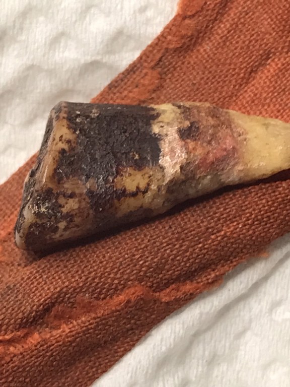 พระทันตธาตุครูบาสองเมือง วัดหล่ายแก้ว อ.บ้านโฮ่ง จ.ลำพูน พระอนันต์ เป็นศิษย์ครูบาสองเมือง ท่านสิ้นชีวิตแล้วเมื่อปี 2539 หากมีชีวิตอยู่ปัจจุบันจะมีอายุ 88 ปี (บันทึก พ.ศ.2566) ได้มอบให้ สจ.บอย อายุ 48 ปี อยู่หมู่บ้านเรือน อ.ป่าซาง จ.ลำพูน