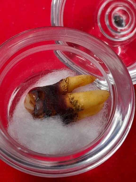 พระทันตธาตุครูบาแก้ว สิริวิชโย วัดดงมะเฟือง อ.แม่ลาว จ.เชียงราย ได้มาจากครูนันทชัย อดีตครูโรงเรียนดงมะดะ ปัจจุบัน (บันทึก 2566) ท่านอายุ 82 ปี ท่านเคยเป็นศิษย์และนับถือครูบาแก้ว ครูนันทชัยท่านเก็บสะสมวัตถุมงคลครูบาแก้ว