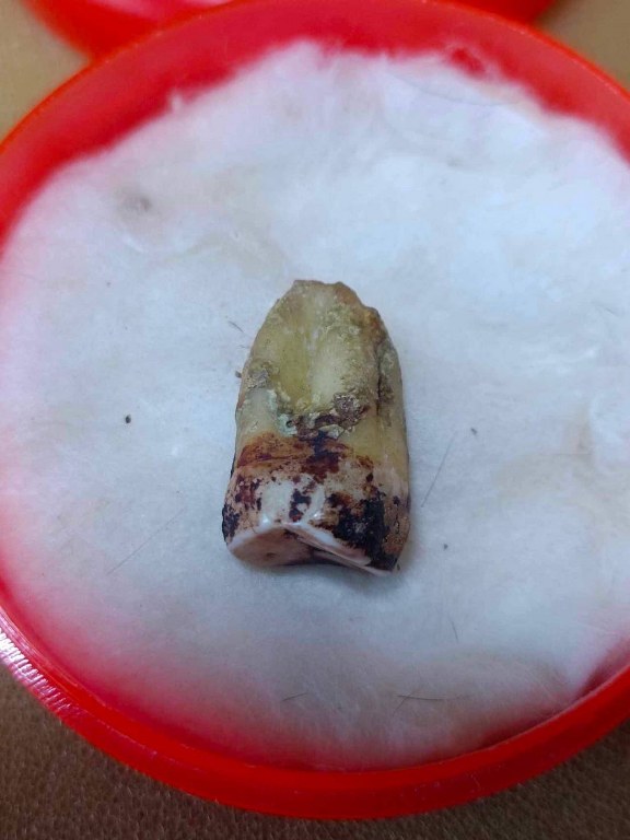 พระทันตธาตุ ครูบาเจ้าเลย วัดป่าบงงาม ต.โป่งงาม อ.แม่สาย จ.เชียงราย เดิมเป็นขอคุณลุงสงวน เคยรับใช้ครูบาเจ้าเลย ขับรถรับส่งครูบาเจ้าไปโรงพยาบาลและสถาน ที่ต่าง ๆ คุณสงวนอยู่บ้านป่าเหมือด อ.แม่สาย จ.เชียงราย ปัจจุบันคุณลุงสงวนเสียชีวิตแล้วตั้งแต่ปี 2558