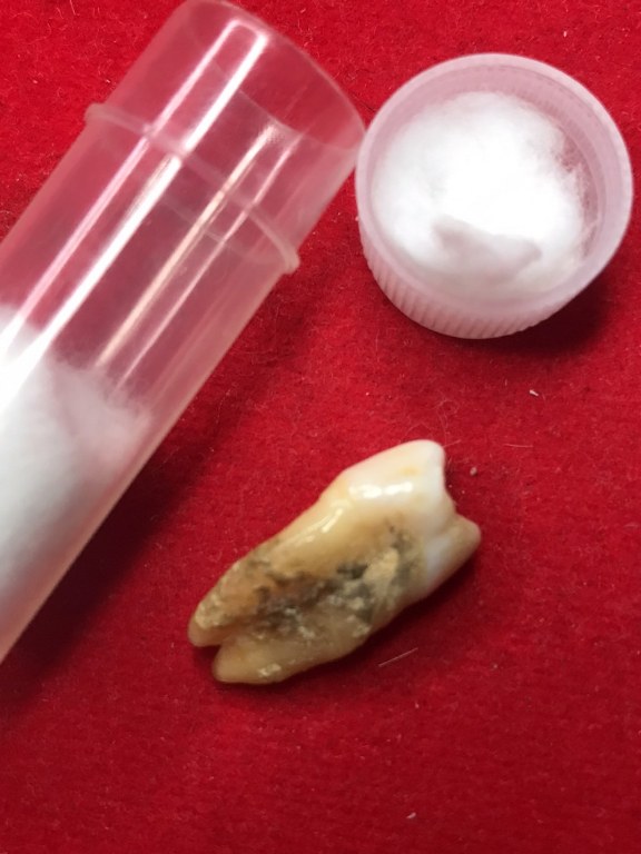 พระทันตธาตุ ครูบาติ๊บ วัดท่าวังพร้าว อ.สันป่าตอง จ.เชียงใหม่ ได้มาจากกำนันคำ อดีตกำนันบ้านปากกอง อ.สารภี จ.เชียงใหม่ ปัจจุบันอายุ 86 ปี (บันทึก พ.ศ.2566) กำนันคำได้พระทันตธาตุครูบาติ๊บ ได้มาเมื่อปี พ.ศ.2549 ได้มาจากลูกศิษย์ครูบาติ๊บ ชื่อลุงวิโรจน์