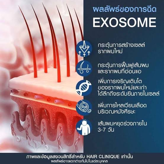 Asce Exosome 1 ขวด เอ็กโซโซม ช่วยดูแลผมร่วงผมบาง Exosome Therapy for Hair Loss