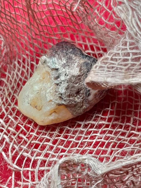 พระทันตธาตุและมีดหมอ ครูบาอิ่นแก้ว วัดสันลิมไม้ อ.แม่สาย จ.เชียงราย ชุดนี้ได้มาจากลุงหนายชัย ซึ่งได้ทั้งพระทันตธาตุและมีดหมอ มาจากศิษย์รับใช้ครูบาอิ่นแก้ว ชื่อลุงแดง ท่านเสียแล้วปี 2550 พระทันตธาตุเก็บไว้ในกระบอกไม่ไผ่ มีชิ้นผ้ารองพระทันตธาตุอยู่