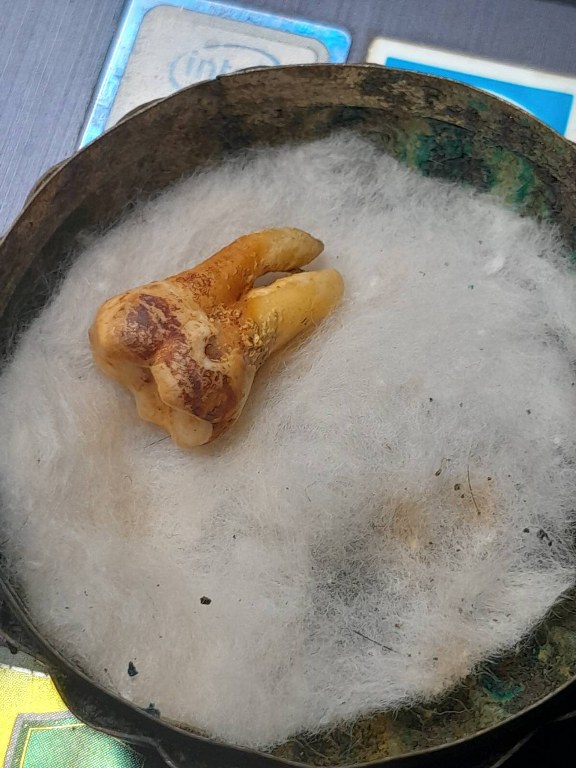 พระทันตธาตุครูบาคำมูล วัดพระบาทแม่ไทย อ.แม่ทะ จ.ลำปาง ได้มาจากครูบรรจง อายุ 92 ปี เสียชีวิตแล้วเมื่อมี 2565 ครูบรรจงเคยสอนที่โรงเรียนใน อ.แม่พริก จ.ลำปาง ครูบรรจงได้รับพระทันตธาตุครูบาคำมูลเมื่อปี 2532 โดยได้รับมาจากศิษย์ฯ ใกล้ชิดของครูบาคำมูล