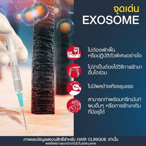 Asce Exosome 1 ขวด เอ็กโซโซม ช่วยดูแลผมร่วงผมบาง Exosome Therapy for Hair Loss