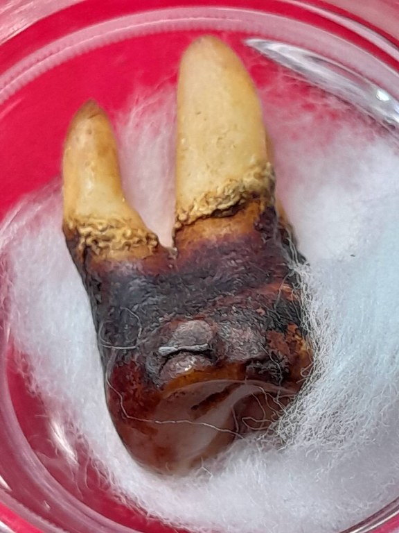 พระทันตธาตุครูบาแก้ว สิริวิชโย วัดดงมะเฟือง อ.แม่ลาว จ.เชียงราย ได้มาจากครูนันทชัย อดีตครูโรงเรียนดงมะดะ ปัจจุบัน (บันทึก 2566) ท่านอายุ 82 ปี ท่านเคยเป็นศิษย์และนับถือครูบาแก้ว ครูนันทชัยท่านเก็บสะสมวัตถุมงคลครูบาแก้ว