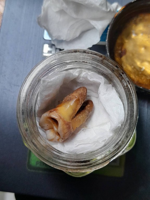 พระทันตธาตุ ครูบาน้อย วัดต๋อมใต้ จ.พะเยา ได้มาจากลุงมา อายุ 74 ปี (บันทึก พ.ศ.2567) เมื่อก่อนลุงมามีอาชีพขับรถตู้ในจังหวัดพะเยา ปัจจุบันให้ลูกชายขับแทน ลุงมาเคยเป็นศิษย์รับใช้ ขับรถส่งครูบาน้อยไปโรงพยาบาล หรือทำกิจของสงฆ์ หรือธุระอื่น ๆ