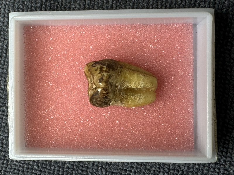 พระทันตธาตุครูบาชิมะระ วัดเวฬุวันองค์นี้ ลุงอำนาจ อายุ 72 ปี ซึ่งมีอาชีพขายข้าวใน อ.ฝาง และ อ.เชียงดาว ได้รู้จักกับพ่อหนานพร อายุ 78 ปี อาชีพเป็นหมอยาแผนโบราณใน อ.เชียงดาว เป็นศิษย์ครูบาวิมะละ ลุงอำนาจได้รับพระทันตธาตุมาจากพ่อหนานพร ในปี 2564