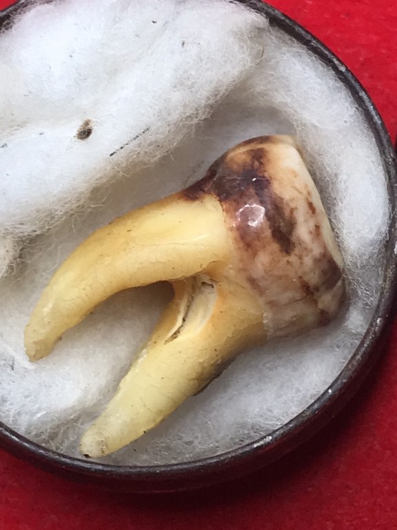 พระทันตธาตุ ครูบาบุญมา วัดแม่สะลาบ จ.เชียงใหม่ ได้มาจากกำนันคำ ซึ่งได้พระทันตธาตุชุดนี้มาจากเพื่อนชื่อเดช อ.สารภี คุณเดช เคยค้าขายข้าวกับท่านกำนันคำ ปัจจุบันเสียชีวิตแล้ว คุณเดช เป็นคนเล่นพระ ให้เช่าบูชาพระในสมัยนั้นด้วย และเป็นศิษย์รับใช้ครูบาบุญมา