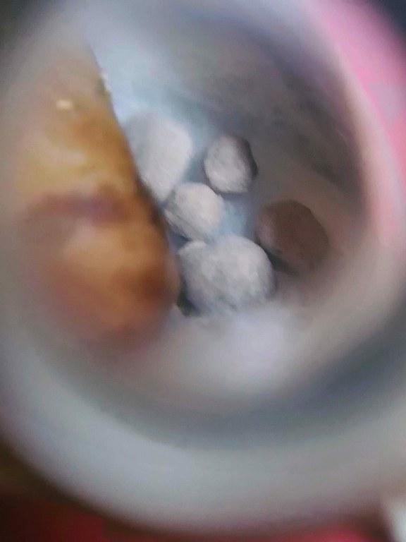 พระทันตธาตุ ครูบาสิทธิ วัดปางต้นเดื่อ อ.แม่อาย จ.เชียงใหม่ เจ้าของเดิมชื่อคุณบอม เคยเป็นเภสัชโรงพยาบาลสันทราย จ.เชียงใหม่ ปัจจุบันอายุ 47 ปี (บันทึก พ.ศ.2566) เคยเป็นศิษย์และนับถือครูบาสิทธิตั้งแต่ปี 2549 - 2555 จนครูบาสิทธิท่านมรณภาพ