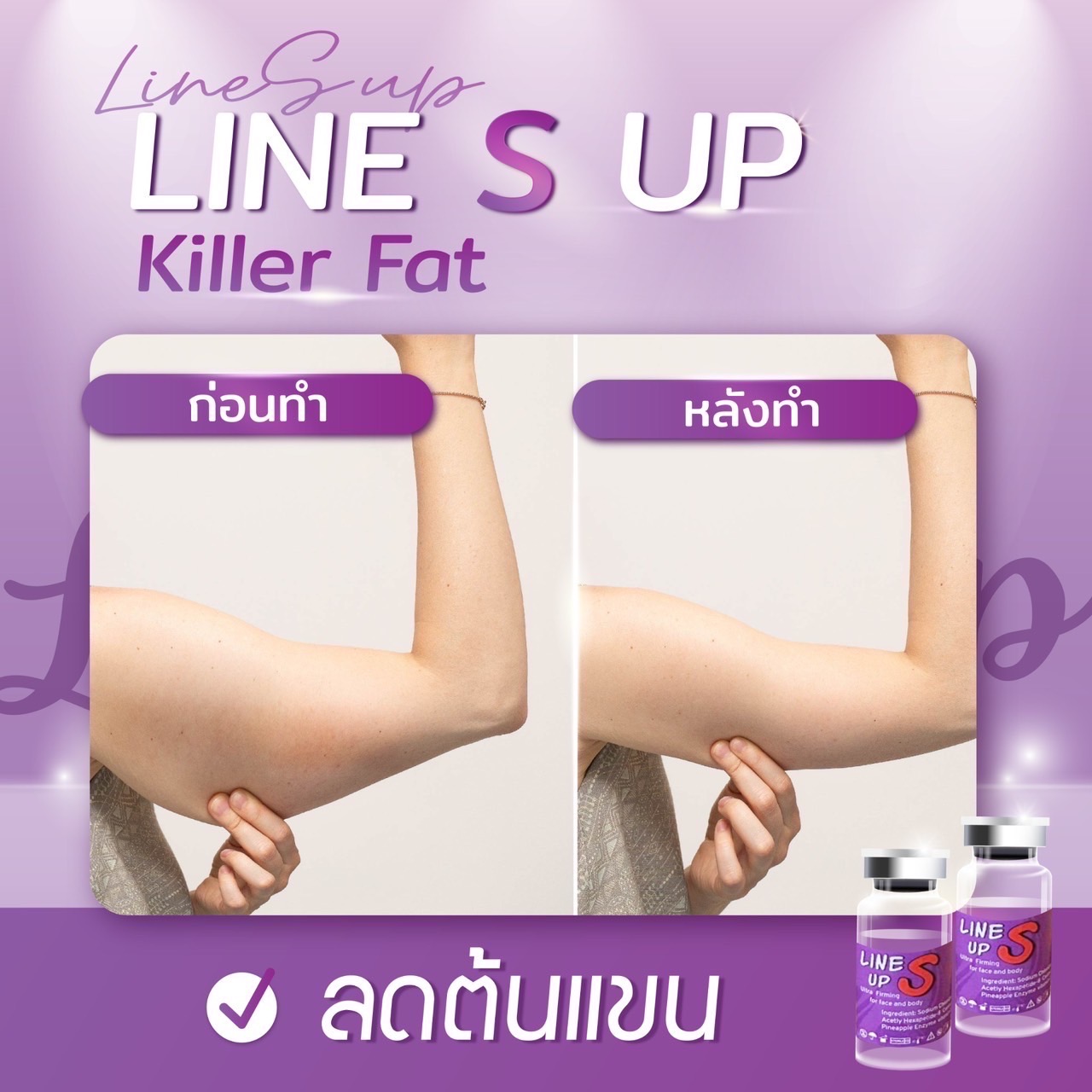 Line S Up / (1 ขวด)