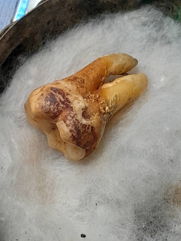 พระทันตธาตุครูบาคำมูล วัดพระบาทแม่ไทย อ.แม่ทะ จ.ลำปาง ได้มาจากครูบรรจง อายุ 92 ปี เสียชีวิตแล้วเมื่อมี 2565 ครูบรรจงเคยสอนที่โรงเรียนใน อ.แม่พริก จ.ลำปาง ครูบรรจงได้รับพระทันตธาตุครูบาคำมูลเมื่อปี 2532 โดยได้รับมาจากศิษย์ฯ ใกล้ชิดของครูบาคำมูล