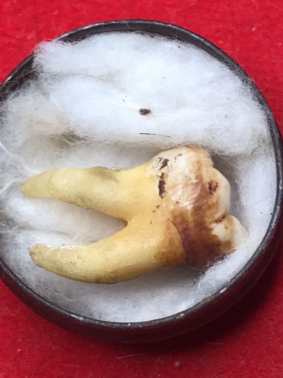 พระทันตธาตุ ครูบาบุญมา วัดแม่สะลาบ จ.เชียงใหม่ ได้มาจากกำนันคำ ซึ่งได้พระทันตธาตุชุดนี้มาจากเพื่อนชื่อเดช อ.สารภี คุณเดช เคยค้าขายข้าวกับท่านกำนันคำ ปัจจุบันเสียชีวิตแล้ว คุณเดช เป็นคนเล่นพระ ให้เช่าบูชาพระในสมัยนั้นด้วย และเป็นศิษย์รับใช้ครูบาบุญมา