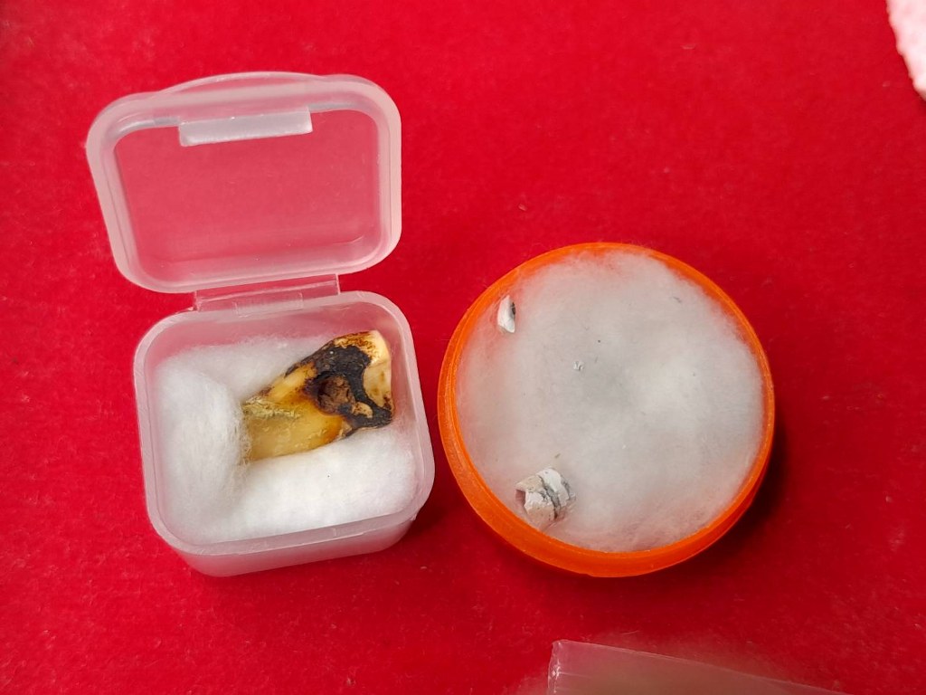 พระทันตธาตุและพระอัฐิธาตุครูบานะ สำนักสงฆ์ดอยอีฮุ้ย ต.ปงแม่ลอบ อ.แม่ทา จ.ลำพูน ได้มาจากผู้ช่วยผู้ใหญ่บ้าน บ้านทาแม่ลอบ อ.แม่ทา จ.ลำพูน ชื่อเดช อายุ 52 ปี ผู้ช่วยเดชเป็นศิษย์ยุคแรกเมื่อปี 2554 ดูแลครูบานะ ช่วยสร้างวัดดอยอีฮุ้ย ผู้ช่วยเดช ไม่ได้ให้ข้อมูลว่า