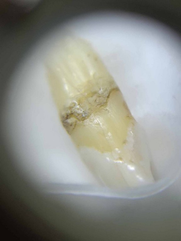 พระทันตธาตุครูบาอินทร์คำ วัดไชยสถาน อ.สารภี จ.เชียงใหม่ ได้มาจากพ่อหลวงชา ปัจจุบันอายุ 68 ปี (บันทึก พ.ศ.2566) อดีตผู้ใหญ่บ้าน ใน อ.แม่แตง จ.เชียงใหม่ พ่อหลวงชาเล่าว่าได้มาจากพ่อหนานทา อายุ 74 ปี เมื่อปี 2553