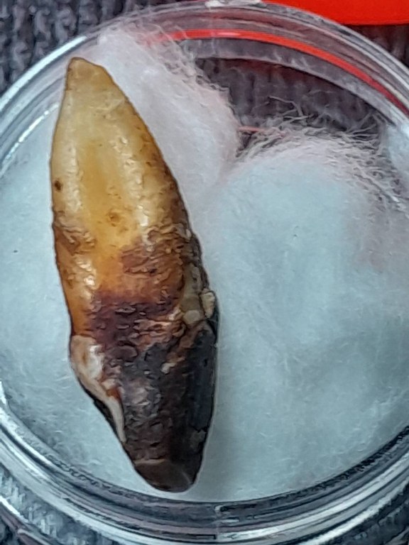 พระทันตธาตุ ครูบาบุญยืน วัดบ้านโฮ่งหลวง อ.บ้านโฮ่ง จ.ลำพูน พระทันตธาตุนี้ได้มาจากพ่อเขียว เป็นคนบ้านสันตับเต่า จ.ลำพูน พ่อเขียวอายุ 78 ปี (บันทึก พ.ศ.2567) ปัจจุบันยังมีชีวิตอยู่ ท่านเป็นกรรมการวัดบ้านโฮ่งหลวงในยุคนั้น ได้รับพระทันตธาตุมาเมื่อปี 2543